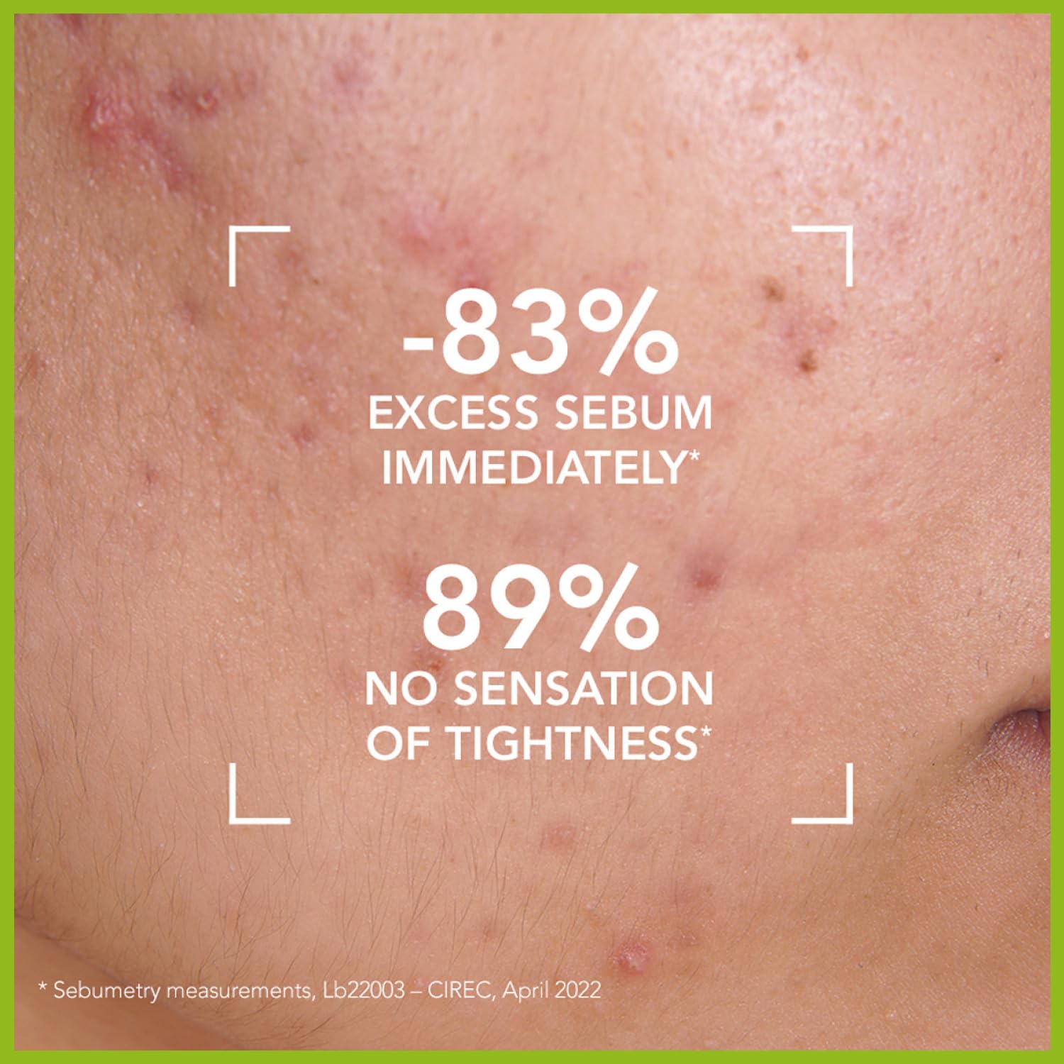 Bioderma - Face Cleanser - Sébium - Makeup Removing Cleanser - Skin Purifying - Face Wash for Combination to Oily Skin